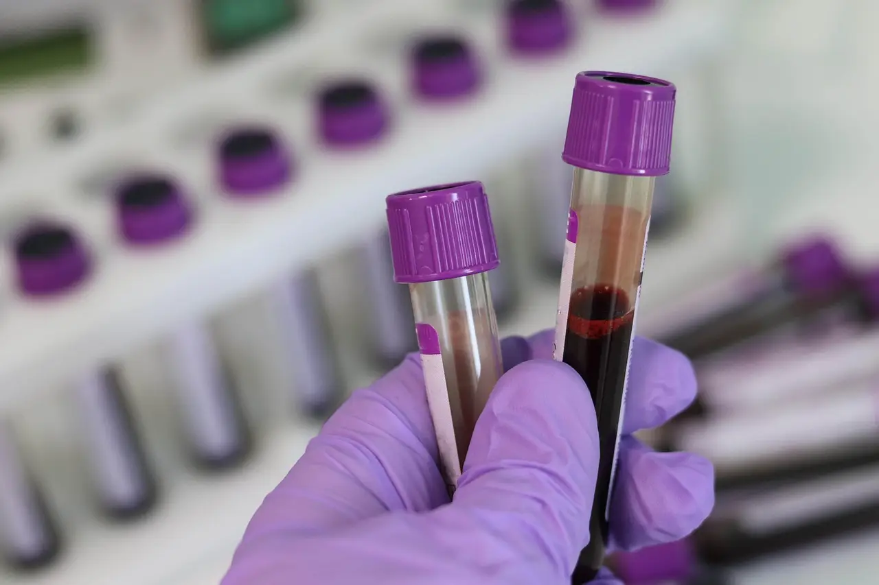 Feline panleukopenia: A diagnostic laboratory's perspective - DVM360